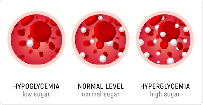 hyperglycemia
